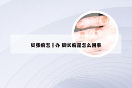 脚张癣怎麼办 脚长癣是怎么回事