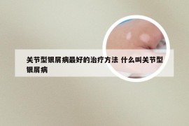 关节型银屑病最好的治疗方法 什么叫关节型银屑病