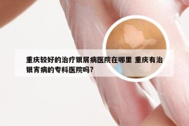 重庆较好的治疗银屑病医院在哪里 重庆有治银宵病的专科医院吗?