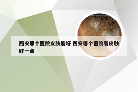 西安那个医院皮肤最好 西安哪个医院看皮肤好一点