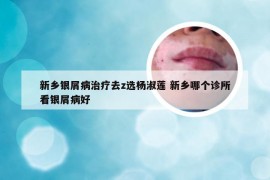 新乡银屑病治疗去z选杨淑莲 新乡哪个诊所看银屑病好