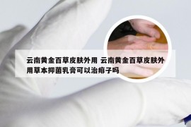 云南黄金百草皮肤外用 云南黄金百草皮肤外用草本抑菌乳膏可以治痱子吗