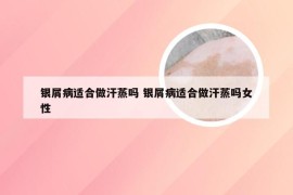 银屑病适合做汗蒸吗 银屑病适合做汗蒸吗女性