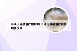 小汤山温泉治疗银屑病 小汤山温泉治疗银屑病多少钱