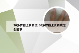 30多岁脸上长白斑 30多岁脸上长白斑怎么回事