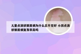 儿童点滴状银屑病为什么总不见好 小孩点滴状银屑病复发率高吗