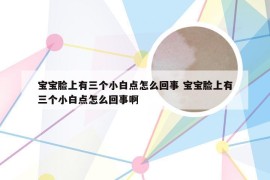 宝宝脸上有三个小白点怎么回事 宝宝脸上有三个小白点怎么回事啊