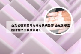 山东省哪家医院治疗皮肤病最好 山东省哪家医院治疗皮肤病最好的