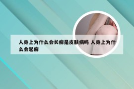 人身上为什么会长癣是皮肤病吗 人身上为什么会起癣