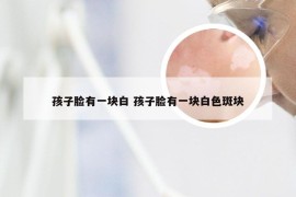 孩子脸有一块白 孩子脸有一块白色斑块