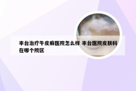 丰台治疗牛皮癣医院怎么样 丰台医院皮肤科在哪个院区