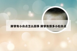 脚掌有小白点怎么回事 脚掌有很多小粒白点