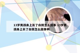 13岁男孩身上长了白斑怎么回事 13岁男孩身上长了白斑怎么回事啊