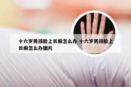 十六岁男孩脸上长癣怎么办 十六岁男孩脸上长癣怎么办图片