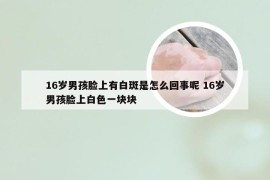 16岁男孩脸上有白斑是怎么回事呢 16岁男孩脸上白色一块块