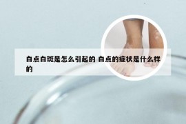 白点白斑是怎么引起的 白点的症状是什么样的