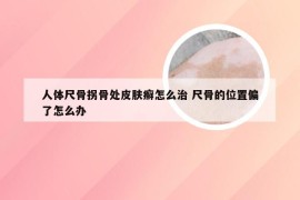 人体尺骨拐骨处皮肤癣怎么治 尺骨的位置偏了怎么办