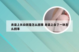 鼻梁上长白斑是怎么回事 鼻梁上白了一块怎么回事