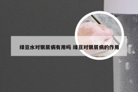 绿豆水对银屑病有用吗 绿豆对银屑病的作用