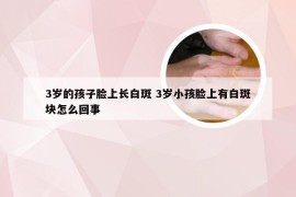 3岁的孩子脸上长白斑 3岁小孩脸上有白斑块怎么回事