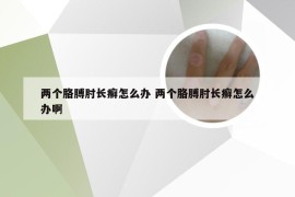 两个胳膊肘长癣怎么办 两个胳膊肘长癣怎么办啊