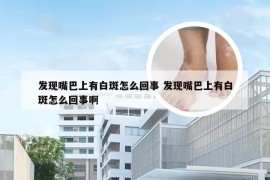 发现嘴巴上有白斑怎么回事 发现嘴巴上有白斑怎么回事啊