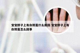 宝宝脖子上有白斑是什么原因 宝宝脖子上有白斑是怎么回事