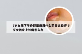 5岁女孩下半身都是癣用什么药膏比较好 5岁女孩身上长癣怎么办