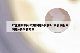 严重银屑病可以用阿维a胶囊吗 银屑病服用阿维a多久有效果