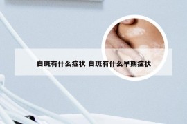 白斑有什么症状 白斑有什么早期症状