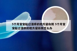 5个月宝宝起过湿疹的地方留白斑 5个月宝宝起过湿疹的地方留白斑怎么办