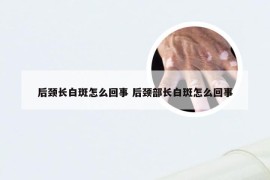 后颈长白斑怎么回事 后颈部长白斑怎么回事