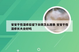 宝宝干性湿疹后留下白斑怎么回事 宝宝干性湿疹长大会好吗