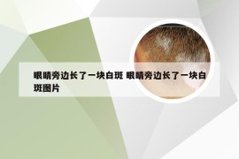 眼睛旁边长了一块白斑 眼睛旁边长了一块白斑图片