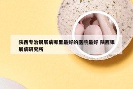 陕西专治银屑病哪里最好的医院最好 陕西银屑病研究所