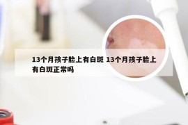 13个月孩子脸上有白斑 13个月孩子脸上有白斑正常吗