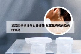 掌跖脓疱病打什么针好使 掌跖脓疱病有没有特效药