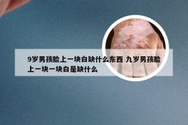 9岁男孩脸上一块白缺什么东西 九岁男孩脸上一块一块白是缺什么