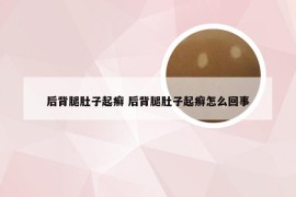 后背腿肚子起癣 后背腿肚子起癣怎么回事