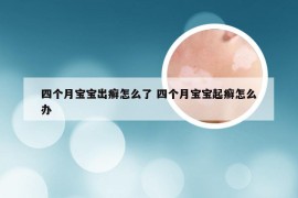 四个月宝宝出癣怎么了 四个月宝宝起癣怎么办