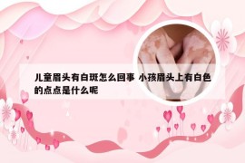 儿童眉头有白斑怎么回事 小孩眉头上有白色的点点是什么呢