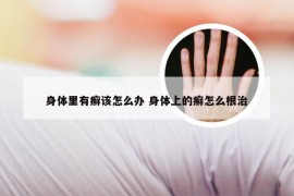 身体里有癣该怎么办 身体上的癣怎么根治