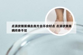 点滴状银屑病去南方会不会好点 点滴状银屑病终身不犯