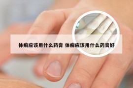 体癣应该用什么药膏 体癣应该用什么药膏好