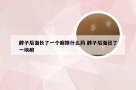 脖子后面长了一个癣擦什么药 脖子后面张了一块癣