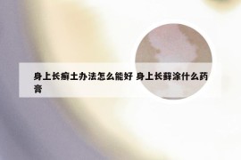 身上长癣土办法怎么能好 身上长藓涂什么药膏