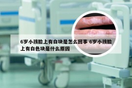 6岁小孩脸上有白块是怎么回事 6岁小孩脸上有白色块是什么原因