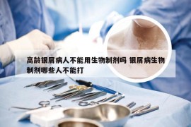 高龄银屑病人不能用生物制剂吗 银屑病生物制剂哪些人不能打