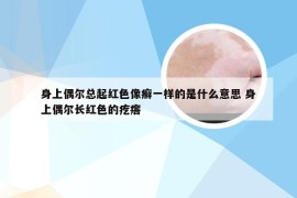 身上偶尔总起红色像癣一样的是什么意思 身上偶尔长红色的疙瘩