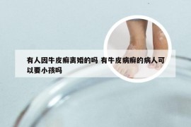 有人因牛皮癣离婚的吗 有牛皮病癣的病人可以要小孩吗